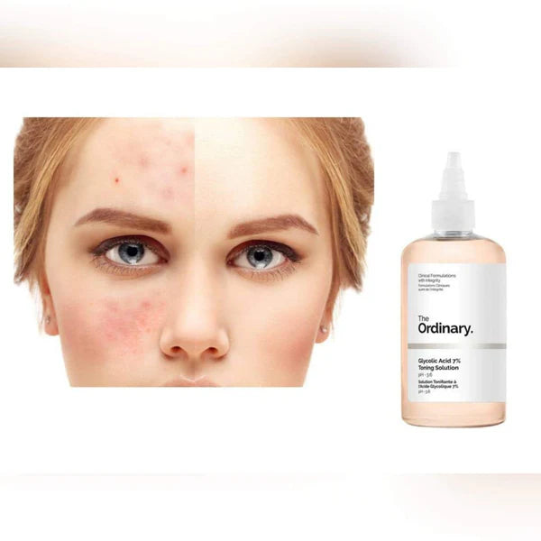Glycolic Acid 7% Exfoliating Toner تونر حمض الجلايكوليك 7% | تفتيح | تقشير | نضارة