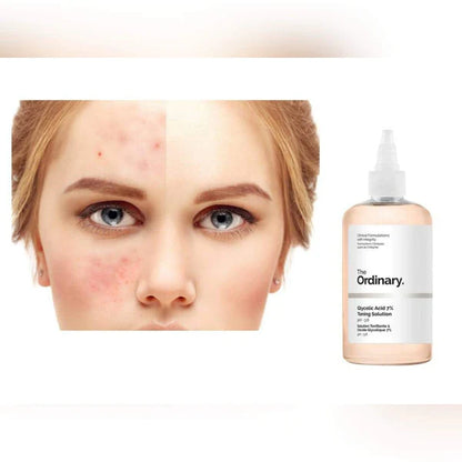 Glycolic Acid 7% Exfoliating Toner تونر حمض الجلايكوليك 7% | تفتيح | تقشير | نضارة